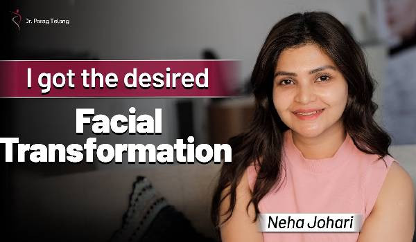 Neha Johri Chin Implant Testimonial